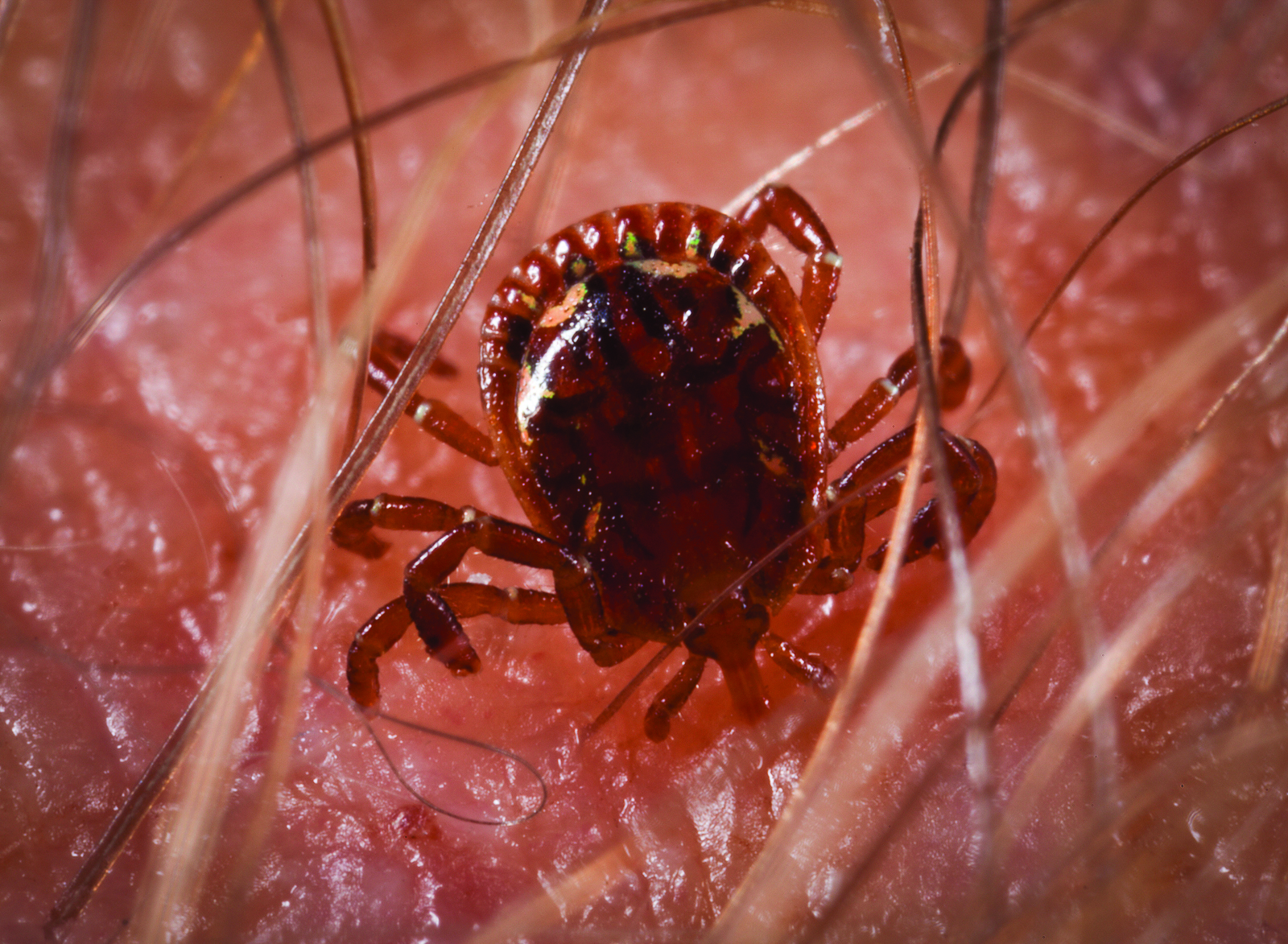 home tick removal service get rid of ticks in home